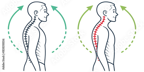 Illustration showing spinal alignment correction with arrows