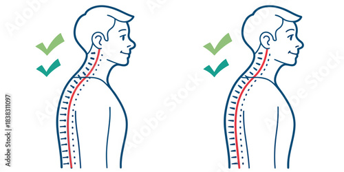 Neck posture comparison good vs bad with spine detail