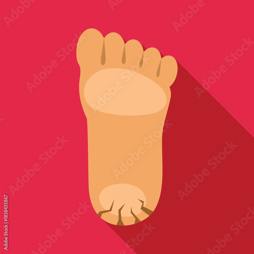 Foot illustrating a common skin condition with dry and cracked heel