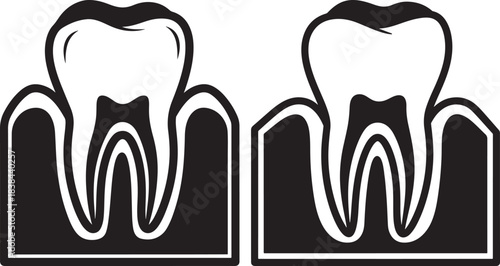 Diagram illustrating healthy tooth structure versus a tooth with gum disease