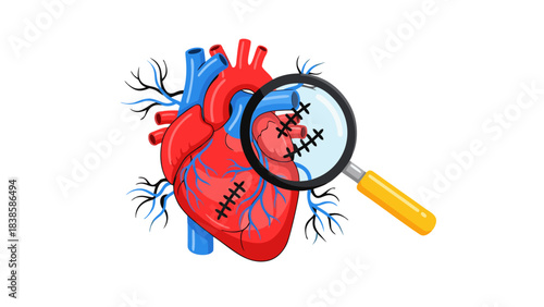 Anatomical Human Heart With Stitches Magnified By A Loupe Demonstrating Medical Examination And Repair On A Black Background
