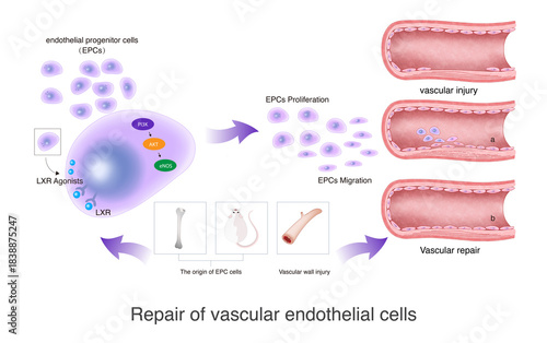 When the vascular endothelium is damaged, primitive progenitor cells can be imported into the body to reach the damaged vascular site and repair the vascular endothelium.
