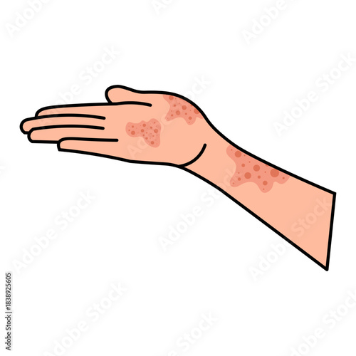 Dermatitis Icon