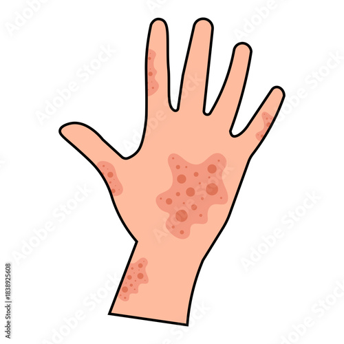Dermatitis Icon