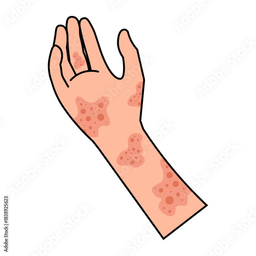 Dermatitis Icon