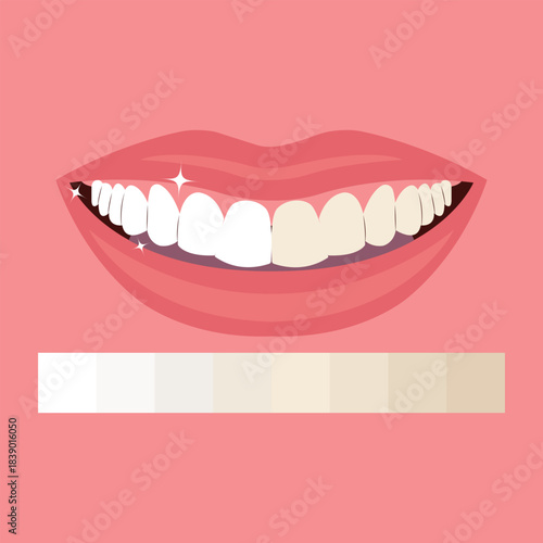 A clean flat-style illustration showing before and after teeth whitening procedure, a smiling mouth, and a dental shade guide representing tooth whitening results.
