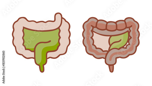 Healthy vs Unhealthy Human Digestive System Illustration