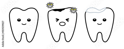 健康な歯と虫歯と白い詰め物で治療した歯のセット