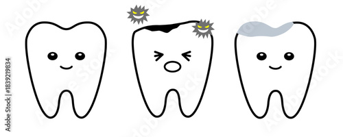 健康な歯と虫歯とメタルインレーで治療した歯のセット