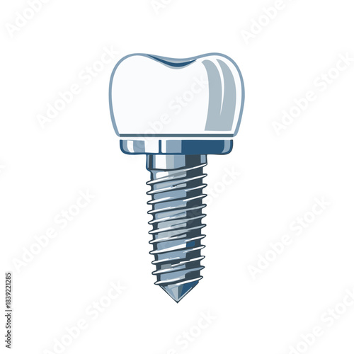 Dental Implant Illustration for Dentistry and Oral Health Promotion Materials