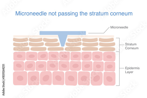 Microneedle insert into layer skin structure passed to Stratum Corneum  before epidermis. Medical nano needle for maintaining the penetration of the beauty ingredients for Smooth skin, anti aging.