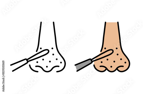 Сleaning the nose with a vidal loop. Vector, editable stroke. Spoon uno sign. 