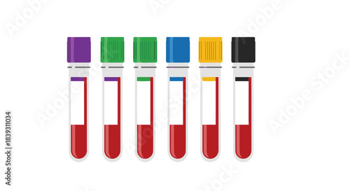 A set of six medical blood collection tubes with different colored caps is shown ready for laboratory testing and analysis.