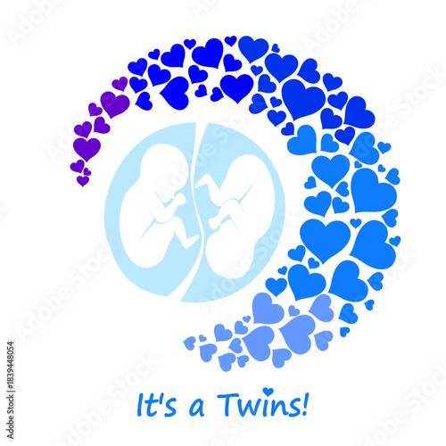 it's twins! Multiple pregnancy. Monozygotic twins (embryos). Design element for pregnancy theme. Maternity, motherhood, baby.  Baby Desire.  Fetus.  Vector illustration