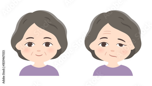 左顔面神経麻痺と健常の高齢女性のイラスト