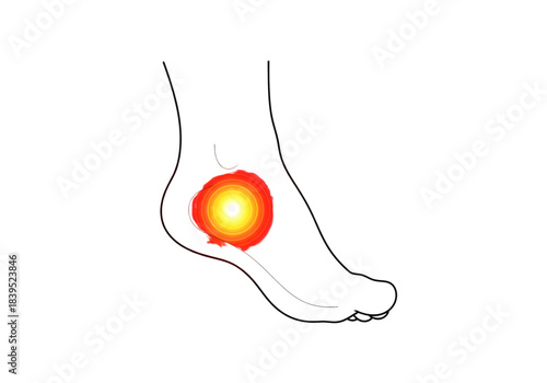 Foot Pain Inflammation Heel Arch Diagram PNG on Transparent Background