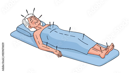 Elderly woman receiving acupuncture treatment while lying on a mat  