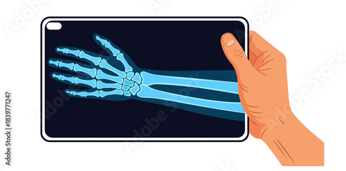 Medical X-Ray Examination An illustrative depiction shows a hand holding a tablet displaying a detailed X-ray scan of a human wrist, showcasing medical imaging and diagnostic technology.