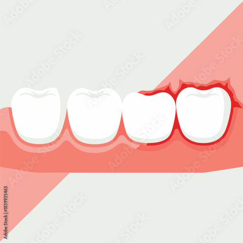 Bleeding Gums and Healthy Teeth Illustration