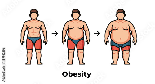 Illustration of a man's body transforming from normal weight to obese, depicted in three stages with an arrow showing progression.