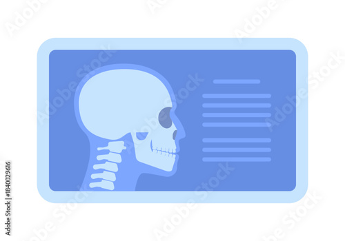 Computer screen with x-ray picture of human head, side view. 