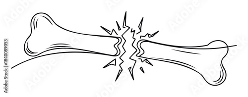 Symbolic line drawing depicting a broken bone with jagged fracture lines and radiating energy, representing injury or damage, useful for medical or conceptrelated projects.