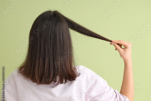 Young woman with hair loss ...