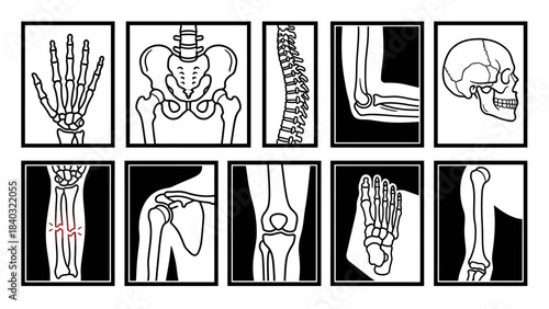 Human Skeletal System Diagram – Labeled Illustrations of Skull, Spine, Joints, Limbs, and Fracture for Medical, Educational, and Orthopedic Reference