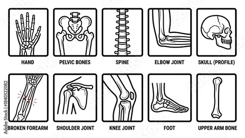 Human Skeletal System Diagram – Labeled Illustrations of Skull, Spine, Joints, Limbs, and Fracture for Medical, Educational, and Orthopedic Reference
