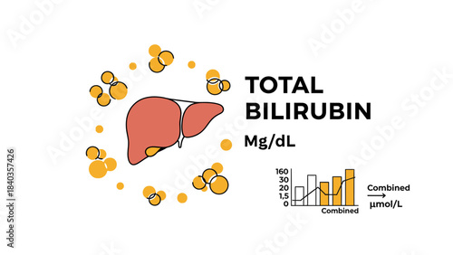 Total Bilirubin Test and Liver Health Monitoring Illustration. Jaundice and Hepatology Concept.