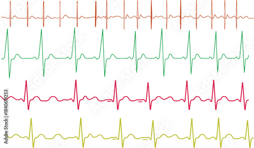 Electrocardiogram heart rate pulse line, medical heartbeat monitor signal, ECG cardiology waveform, healthcare diagnostic technology background, blue digital medical design