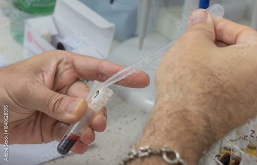 Transferring Blood Sample Into a Test Tube
