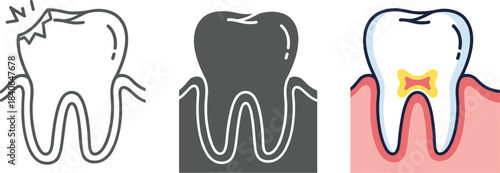 Tooth decay stages isolated on white background healthy tooth, initial caries, and advanced decay, dental health, oral hygiene, and prevention concept
