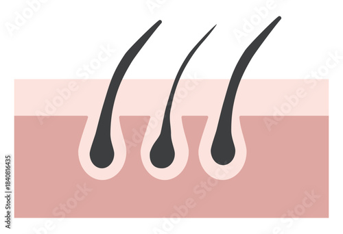 Hair Follicle and Pore Cross-Section Illustration Showing Skin Structure