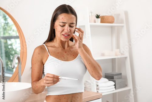 Fotografie Young woman ill with chickenpox and thermometer scratching in bathroom
