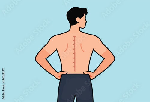 A vector illustration depicts a bare-chested man with a scar down his back. Hands on hips, on a blue background