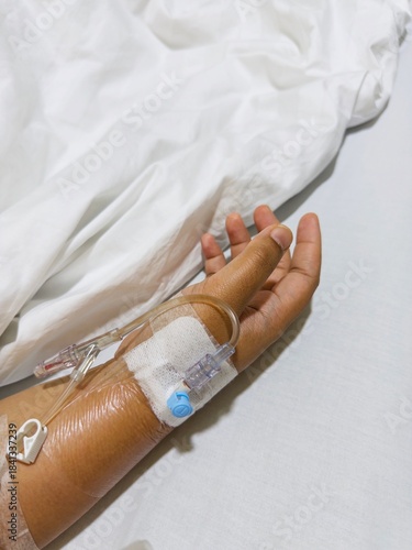 Close-up of patient's hand resting on white bed sheet with IV drip attached, showing medical tape securing needle on hand