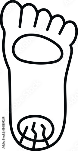 Foot showing cracked heel skin and a callus or bunion