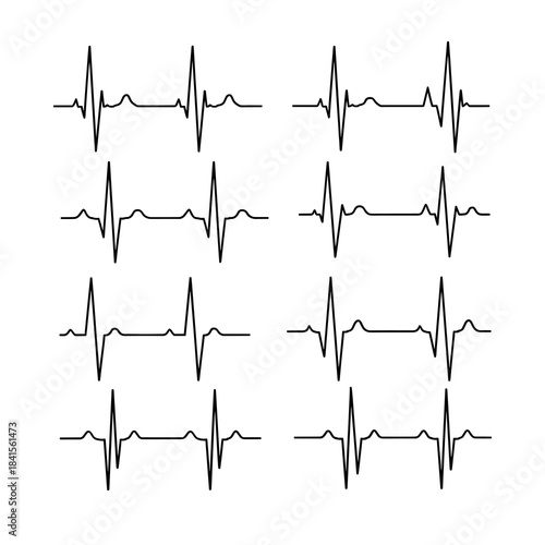 Electrocardiogram waveforms displayed in grid pattern