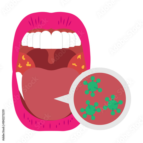 Mouth Infection Illustrator