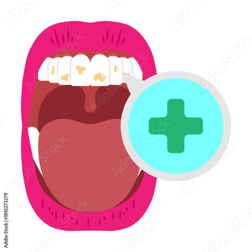 Mouth Infection Illustrator