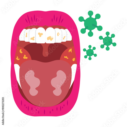 Mouth Infection Illustrator