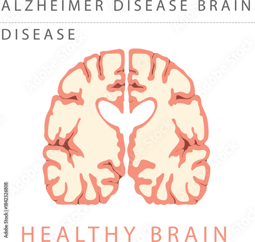ALZHEIMER
