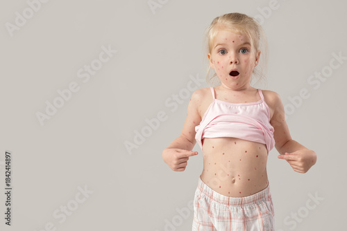 Shocked little girl ill wit...