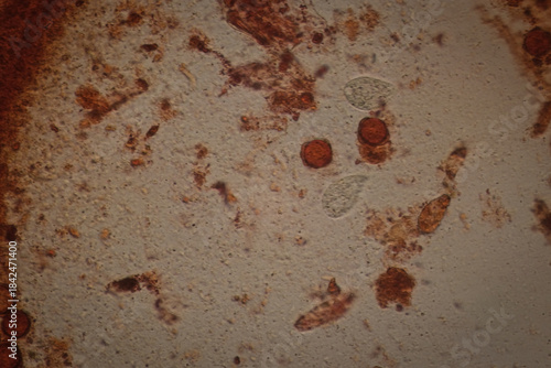 Photos Microscopic Field View of a Putrefaction Sample, Revealing Fungal Spores, Microb