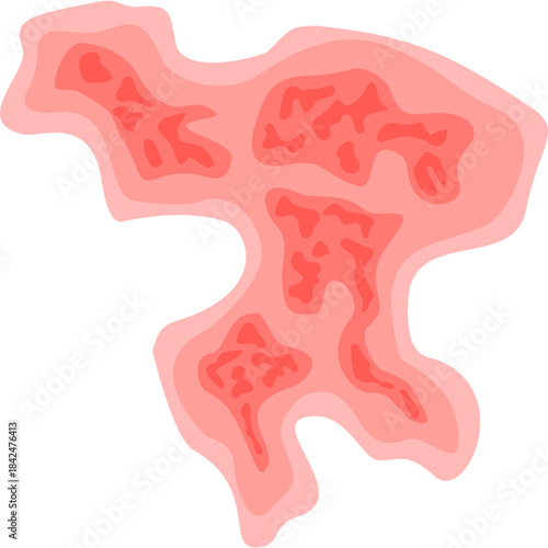 Zoster virus illustration