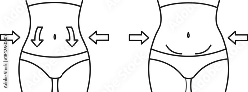 Body contouring line icons showing stomach slimming, fat reduction, body shaping, before and after waist transformation illustrations for cosmetic and wellness design