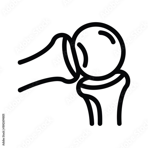 Hip joint dislocation illustration