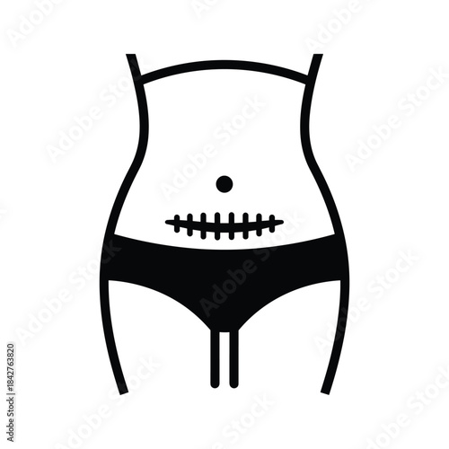 Woman's abdomen with surgical scar