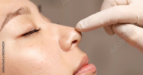 Doctor examining female nose profile for non-surgical rhinoplasty.